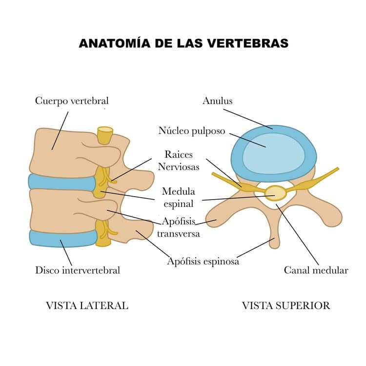 Vista lateral y superior del disco intervertebral, mostrando su ubicación entre las vértebras y detallando sus componentes principales: anillo fibroso y núcleo pulposo.